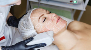 High Intensity focused ultrasound