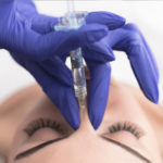 Nose Job-Dermal Filler-Non Surgical Rhinoplasty