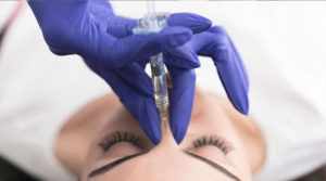 Nose Job-Dermal Filler-Non Surgical Rhinoplasty